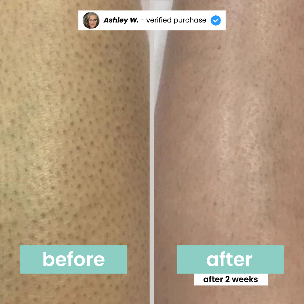 Hair Inhibitor Stop hair Growth