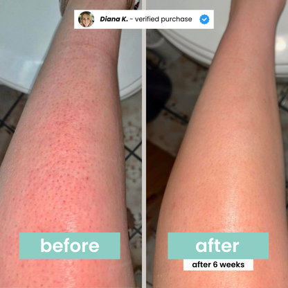 Hair Inhibitor Stop hair Growth