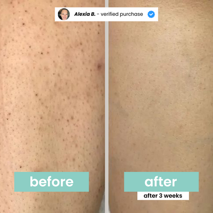 Hair Inhibitor Stop hair Growth