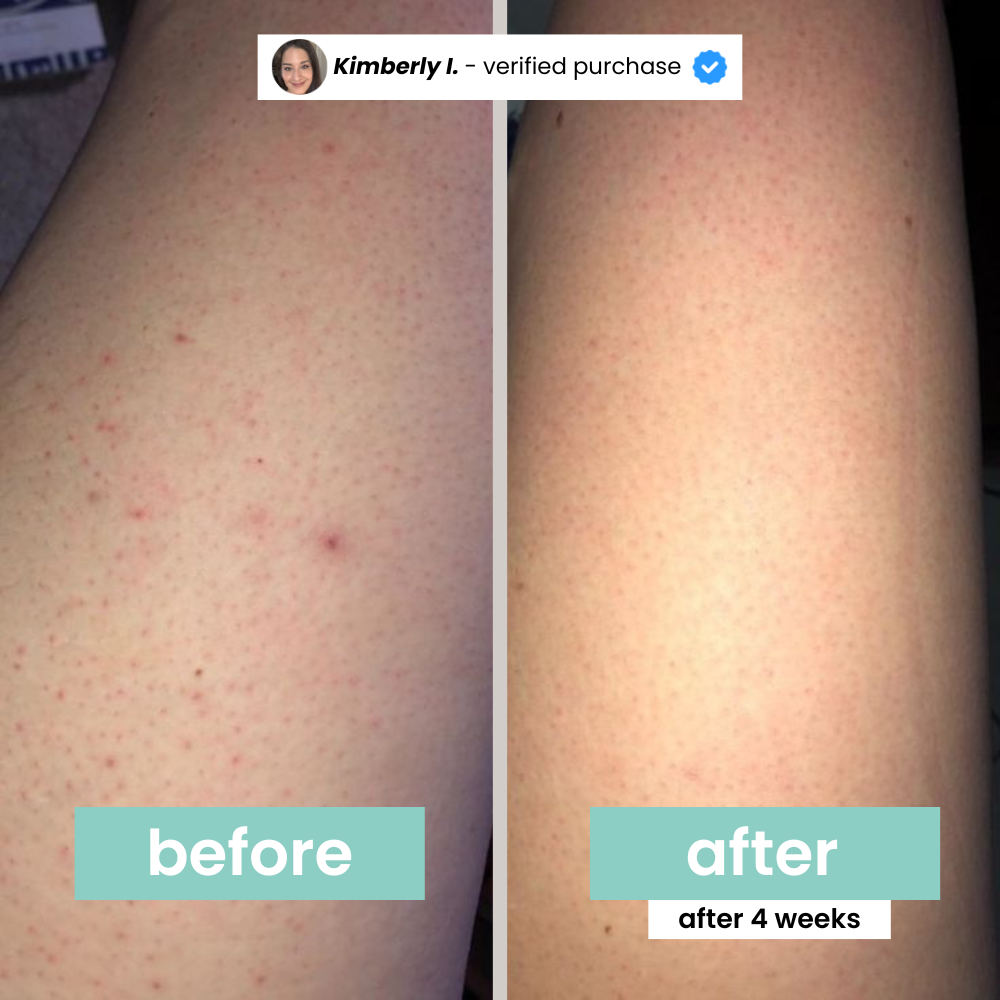 Hair Inhibitor Stop hair Growth